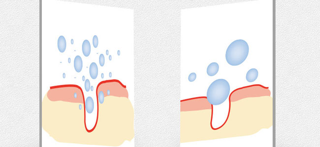 �����������ᱣ���iˮԭҺ