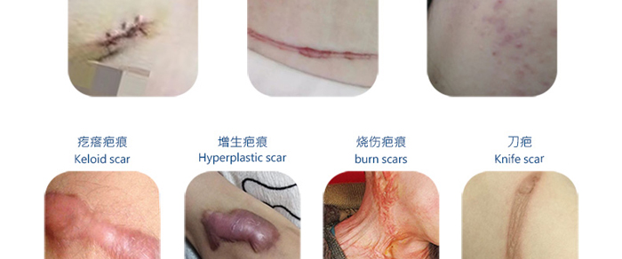 �����t(y��)�����Ϳ��t(y��)�ù�ͪ���z����