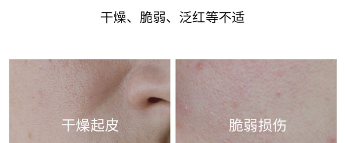 Դ��ˮԪ�����B(y��ng)˪