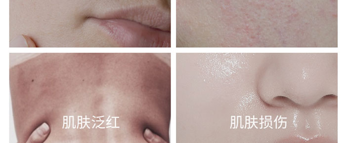 Դ��ˮԪ�����B(y��ng)˪