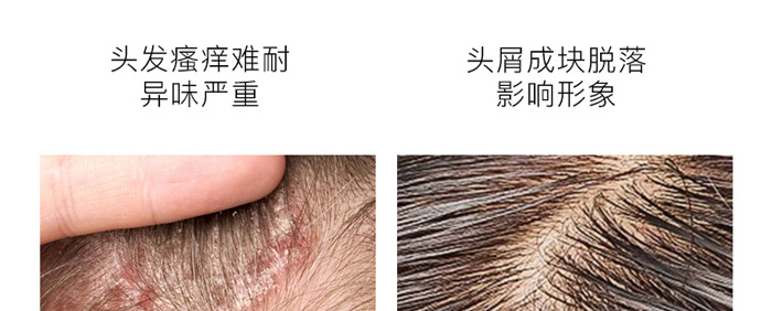 ����ֲ��ȥм����ϴ�l(f��)��