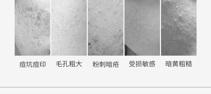 �������������ɷ��׺�