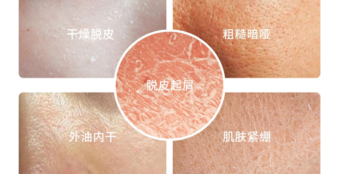 �������ѩ������o(h��)���