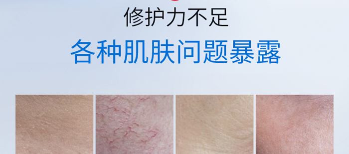 ��ޢѩ�����AҺ